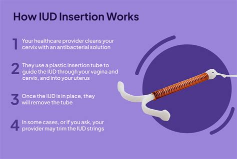 People should see a doctor if the following symptoms appear shortly after IUD insertion a fever above 101F; chills; intense or unbearable cramping; strong, sharp pain in the stomach; very heavy. . Diarrhea after copper iud insertion